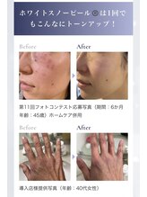 エステティック レイビス 川崎店(RAYVIS)/