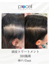 ユミト(Umit)/プロセルスカルプ