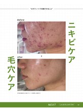 パピヨン バイ シュシュ 北見市(Papillon by Chou Chou)