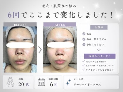 ミヨンラボ(miyon LABO)の写真