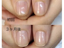 アイネイルズ(Ai nails)/形改善【ネイルケアコース】