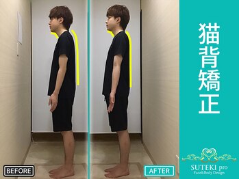 美骨矯正 ステキプロ(SUTEKI pro)/ストレートネック・猫背・姿勢