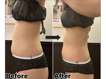 カピリナ(Kapilina)/ WINBACK60 1回【20代前半女性】