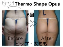 アネラ(ANELA)の雰囲気（ピンポイントで脂肪減少・皮膚の引き締めケアとともに代謝UP）