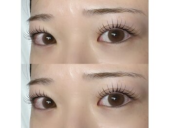 エティナル 上小田井(eternel)/&ヘルシー+フラット120本