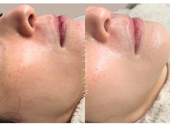 ウォナ(WONA)/【お客様症例】