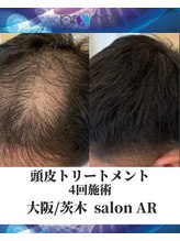 メンズサロンアール(AR)/プロセルセラピーズ