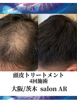 メンズサロンアール(AR)/プロセルセラピーズ