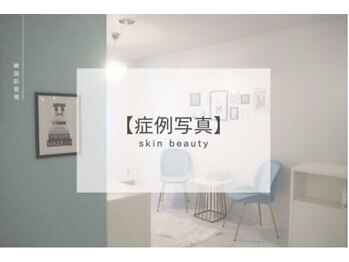 小顔・痩身専門店Lift(リフト)練馬/小顔専門店Lift|Before After