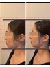 浮腫み・頭痛・小顔矯正/頭蓋骨×首から解く本格専門技術60分22000→¥11000