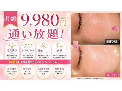 アンテグラールの写真