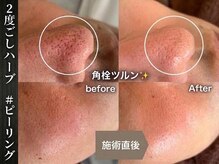 タイム(THYME)