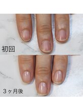アイネイルズ(Ai nails)/形改善【ネイルケアコース】