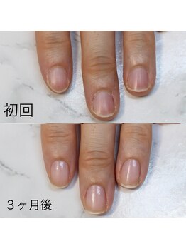 アイネイルズ(Ai nails)/形改善【ネイルケアコース】