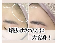 スムース(SMOOTH)/フェイスワックス/顔脱毛　