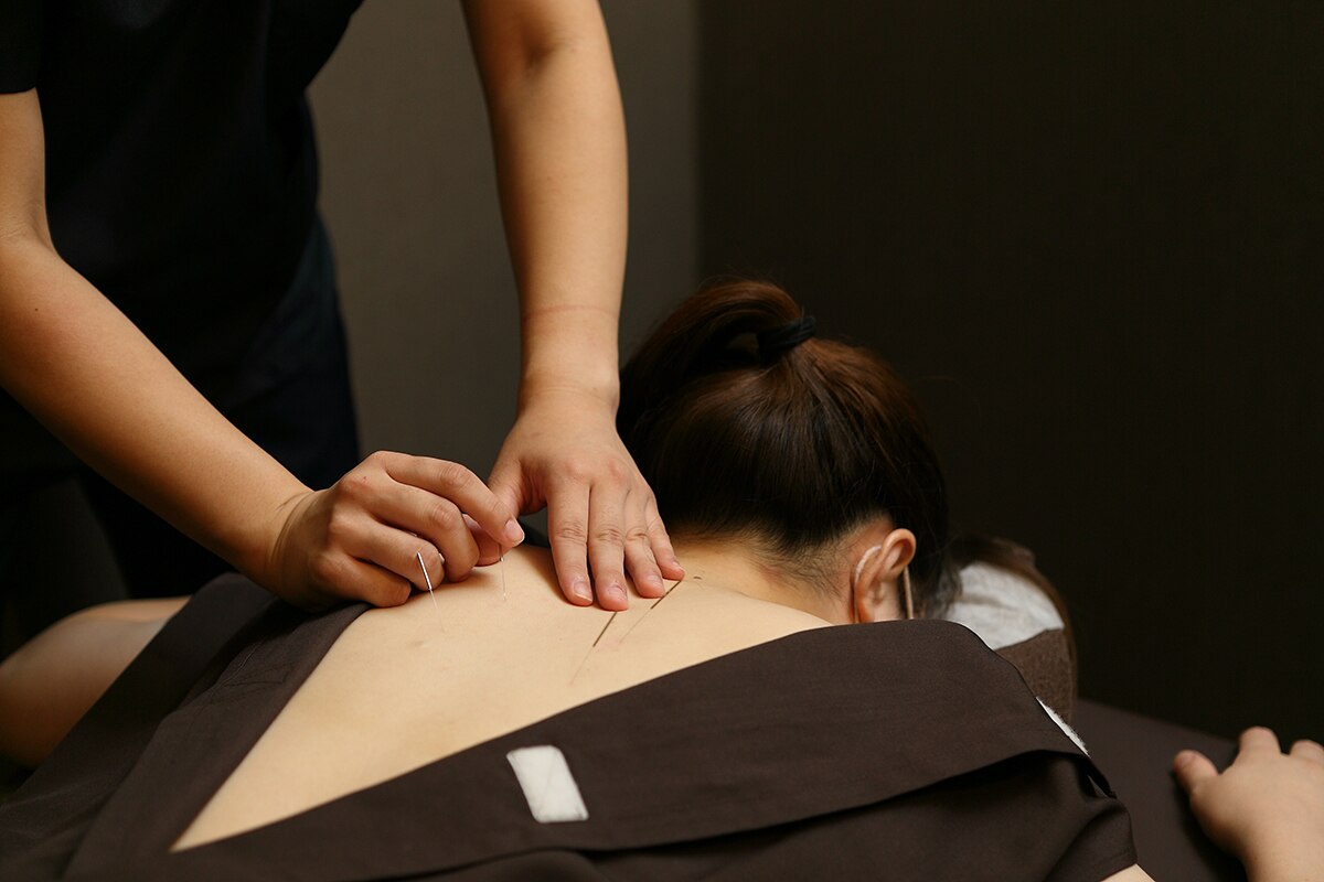 スターズ鍼灸整骨院 学芸大学院｜ホットペッパービューティー