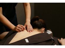 スターズ鍼灸整骨院 学芸大学院の雰囲気（鍼灸施術・美容鍼・インディバ のご用意もあります。）