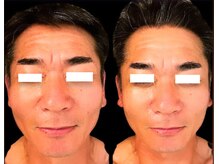 ジーニー(Genie)/ララピール始めました！