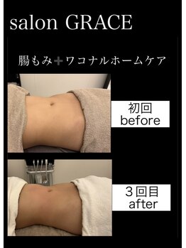 サロン グレイス(salon GRACE)/
