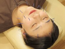 江古田りんく鍼灸整骨院