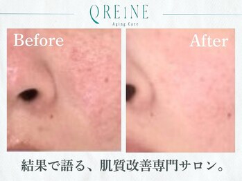 クレーヌ(QREiNE)