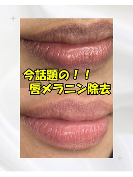 ワイスタイル(Ystyle)の写真/唇の暗さが気になるあなたへ！色素にアプローチし、ローマピンクの輝きを☆