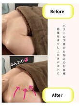 アール(R)/バストケア