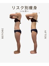 ビーシェイプ 君津(B-Shape)/【痩身】ビフォーアフター
