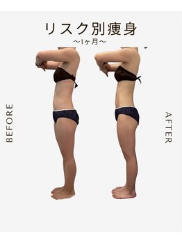 ビーシェイプ 君津(B-Shape)/【痩身】ビフォーアフター