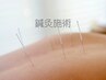 【肩こり/腰痛◎】完全オーダーメイド鍼灸施術45分¥5220→