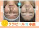 ウルオイ 海老名(URUoi)の写真/【小顔を継続したい方は必見！】首・肩・肩甲骨から整えて戻りづらい本物の小顔へ導く新常識を体験


