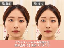 【小顔矯正・顔の歪み矯正・骨盤矯正・姿勢矯正】美容整体プラスフィール広島袋町店の雰囲気（小顔矯正で最短結果◎[広島袋町/整体/小顔矯正/骨盤矯正]）