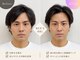 クオン(KUON)の写真