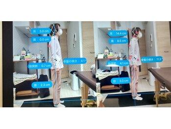 彩(イロドリ)/ 治療後のbefore after