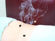 荻窪接骨院 荻窪治療室