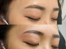 ブリエ(Briller)/ハリウッドブロウリフト