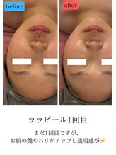 ユフラ(Juhla)/ララピール