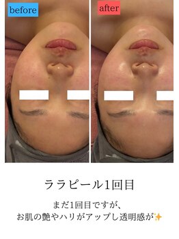 ユフラ(Juhla)/ララピール