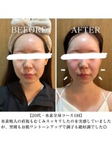 ヨサパーク リバティ 池袋東口店(YOSA PARK Liberty)/Before&After