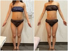 美容整体ウェリナ あま甚目寺院/小顔矯正/骨盤矯正/美脚サロン