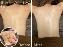 ブリス 渋谷駅前(BliSS)の雰囲気（★ブライダル★ BliSS式【背中美人プログラム】で花嫁準備）