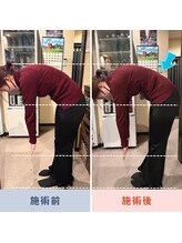ナゴミ鍼灸 整体院(NAGOMI鍼灸 整体院)/腰痛の前屈改善/出張整体
