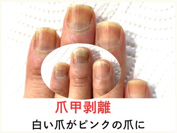 広島深爪専門ネイルサロン ナッカ/
