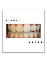 セルフダック 会津若松店(SELFDUCK)/BeforeAfter