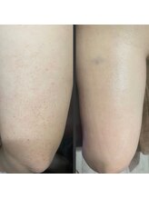 スウィートマジョラム(Sweet Marjoram)/Eライトボディ