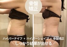 カンフリエ 吉野ヶ里店(Camphrier)