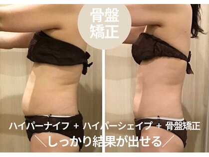 カンフリエ 吉野ヶ里店(Camphrier)の写真