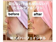 サロン ド プリヴェ(Salon de PRIVE)の雰囲気（ハイパーナイフ&シェイプ痩身のビフォアフはフォトギャラリーへ）