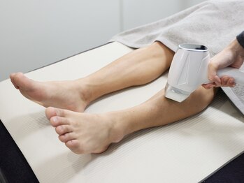 チャッピー(CHAPPY)/