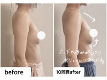 つばききよら/１０回でボリュームアップ！